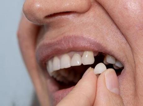 Diş kaybının yalnızca estetik bir sorun olmadığına dikkat çeken Protetik