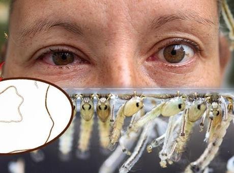 Betül Yasemin Kökbek / Milliyet.com.tr – Romanya’da yaşayan 26 yaşındaki