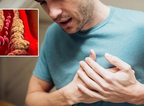 Kötü kolesterolün (LDL) çoğu zaman hiçbir belirti vermeden damarlarda birikebildiğini