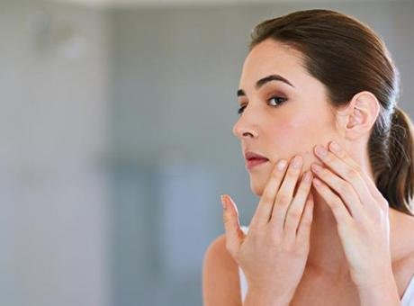 SON dönemde yetişkin aknesi vakalarında patlama yaşandığını belirten Dermatoloji Uzmanı