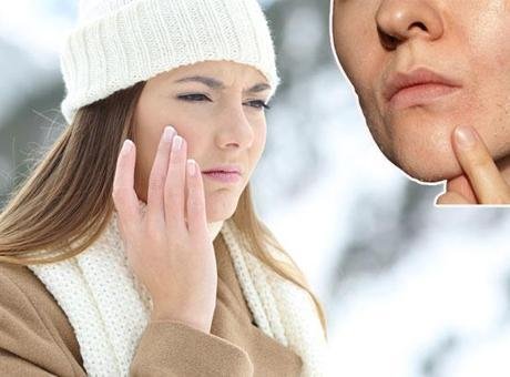 Soğuk hava, rüzgâr ve kapalı ortamlarda artan ısı derken kış