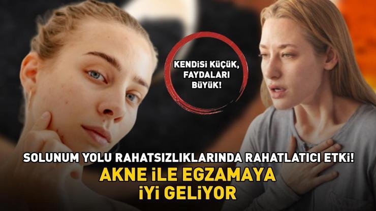 AKTARLARIN EN ÇOK SATANI! Faydaları saymakla bitmiyor: Akne ile egzamaya iyi geliyor; solunum yolu rahatsızlıklarında rahatlatıcı etki gösteriyor Kaynak:Cnnturk.com Doğanın bize sunduğu mucizevi bitkiler arasında yer alan çörek