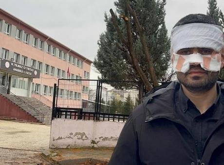 Olay, Yılmaz Çetintaş Anadolu Lisesi’nde meydana geldi. İddiaya göre; fizik