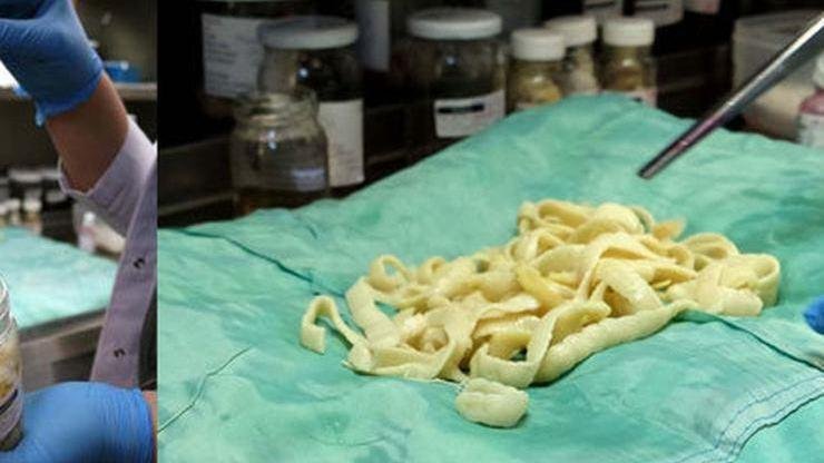 Tenya Nedir? Daha küçük bağırsak parazitleri olan tenyaların diğer biçimleri