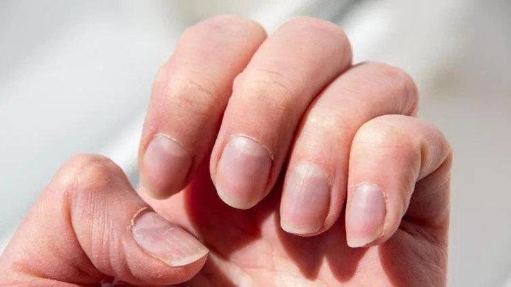 Tırnak İçin Hangi Doktora Gidilir? Tırnak ile ilgili oluşan tüm