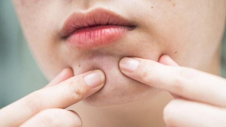 Yağ Bezesi İçin Hangi Doktora Gidilir? Yağ bezeleri vücudun birçok