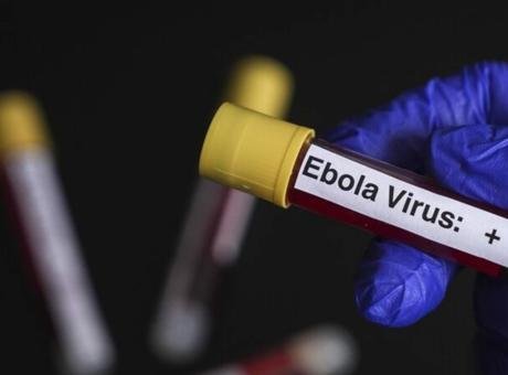 Avrupa’nın göbeÄŸinde ‘Ebola’ alarmı! Hastaneler ve doktorlar harekete geçirildi Resmi haber ajansı Belga’ya göre, Federal Kamu SaÄŸlığı Kurumu, ülkede