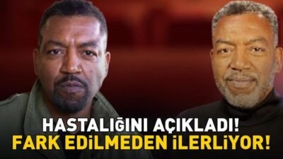Grey’s Anatomy’nin Yıldızı Russell Andrews Hastalığını Açıkladı! Bu Belirtilere Dikkat! Fark Edilmeden İlerliyor! Kaynak:Cnnturk.com 64 yaşındaki ABD’li oyuncu Russell Andrews, 2025 yılında ALS