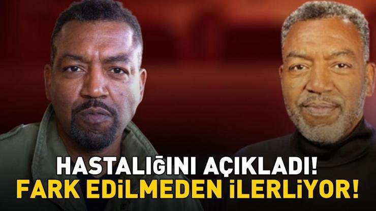 Kaynak:Cnnturk.com 64 yaşındaki ABD’li oyuncu Russell Andrews, 2025 yılında ALS