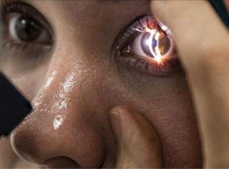 İnsan vücudunda ‘üçüncü göz’! Neden orada olduğu ortaya çıktı MİLLİYET.COM.TR – İngiltere ve İsveç’ten bilim insanlarının yer aldığı bir