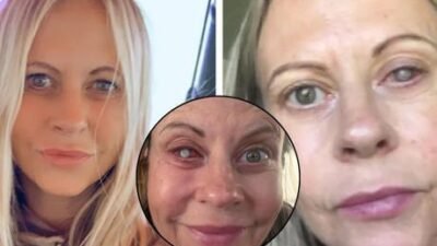 İngiltere’de yaşayan 47 yaşındaki Emma Marsden, kontakt lenslerini çıkarmadan yüzünü
