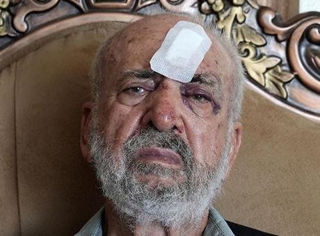 İsrail askerlerinden 80 yaşındaki Filistinliyi darbederek yaraladı Filistin Kızılayından yapılan açıklamada, sağlık ekiplerinin, İsrail askerlerinin Turmusaya beldesinde
