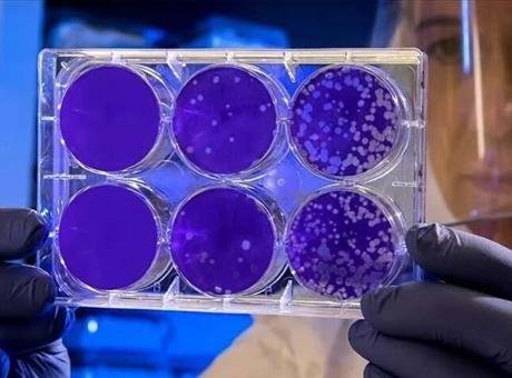 Avrupa’da virüs paniği: Can kayıpları artıyor! Hollanda’da Batı Nil virüsü paniği yaşanıyor. Hollanda Halk Sağlığı ve