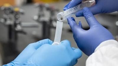 Rus TASS haber ajansına göre, Rusya İnsan Sağlığı ve Tüketici